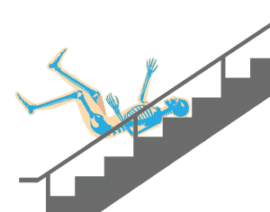 slipping down stairs